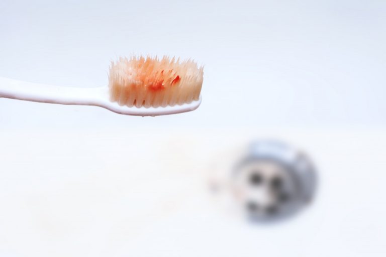 Blood on a toothbrush, bleeding gums after brushing
